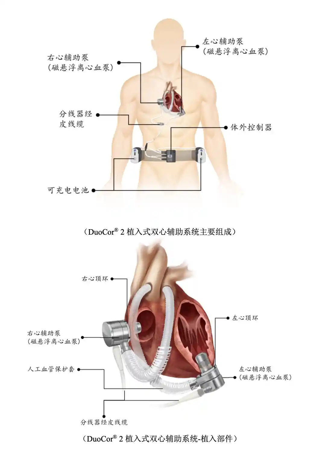 破局者登场!中国最大人工心脏企业登陆科创板,12亿募资引爆IPO新高潮