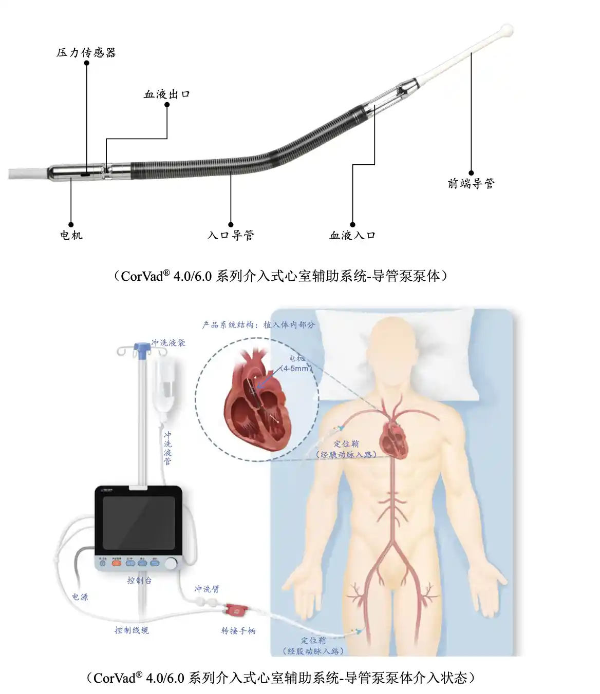 破局者登场!中国最大人工心脏企业登陆科创板,12亿募资引爆IPO新高潮